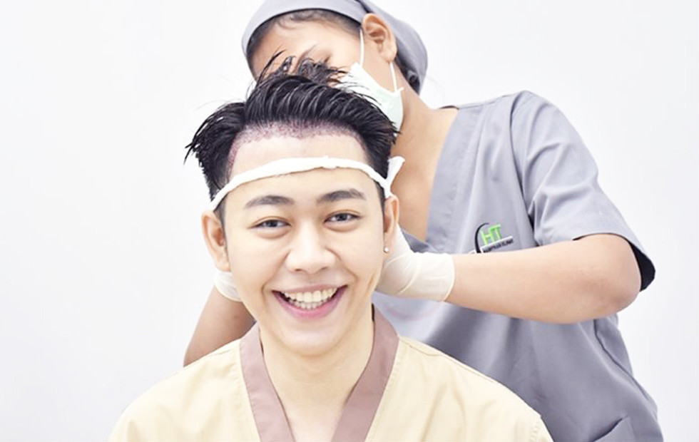 Post-operative care after a hair transplant surgery - Hairtran Clinic
