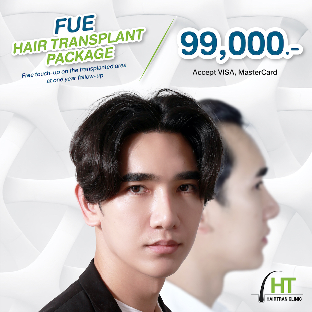 Fue Hair transplant bangkok (Thailand) - Hairtran Clinic